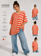 ✨ Oversize Kurzarmshirt – Streifenliebe trifft Trendstyle ✨